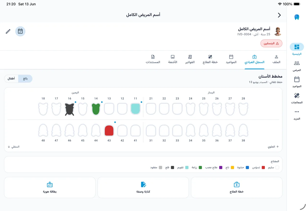 ايفورا — web