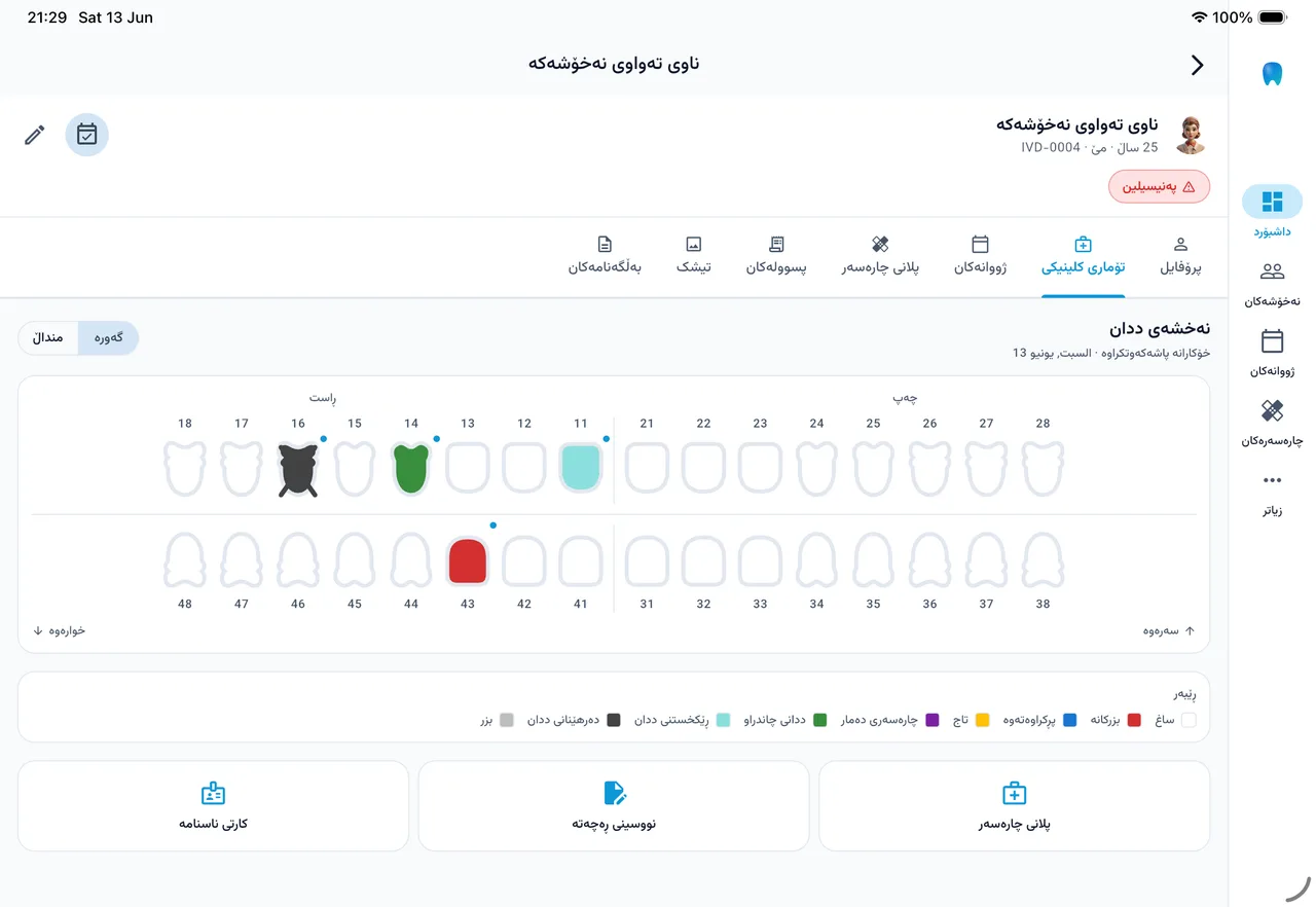 ايفورا — web